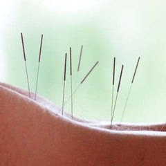 Acupuncture Needles